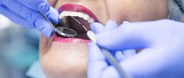 Best Emergency Wisdom Tooth Extraction in Quincy, MA